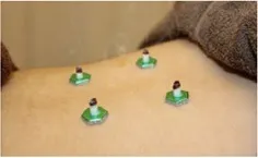 お灸による温熱療法で女性特有の「冷え性」などを改善・解消