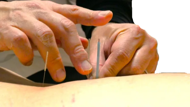 当鍼灸整骨院での腰痛・肩こり・首の痛み改善施術